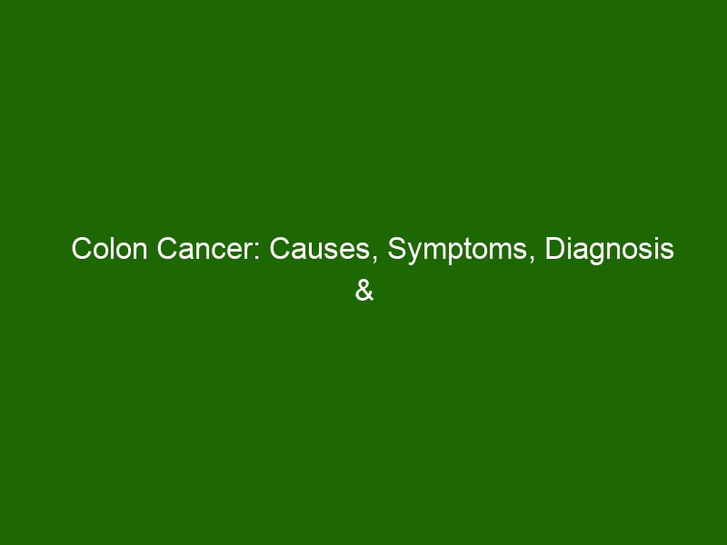 Colon Cancer Causes Symptoms Diagnosis And Treatment Health And Beauty