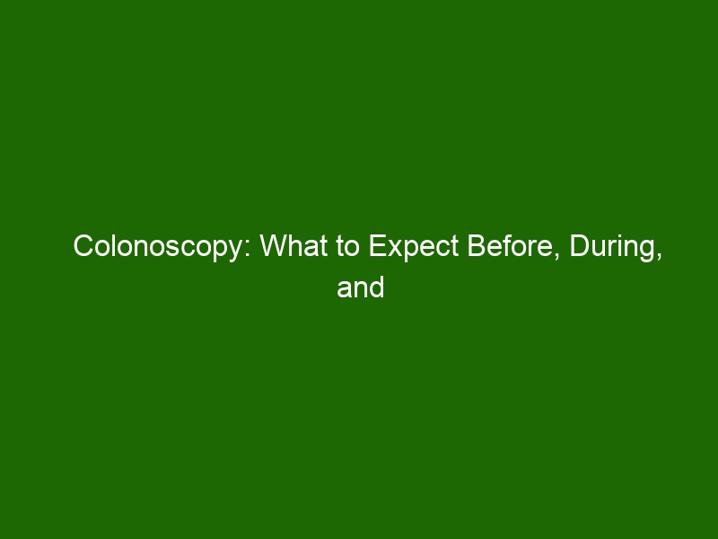 Colonoscopy What To Expect Before During And After Your Procedure   Colonoscopy What To Expect Before During And After Your Procedure 31223 