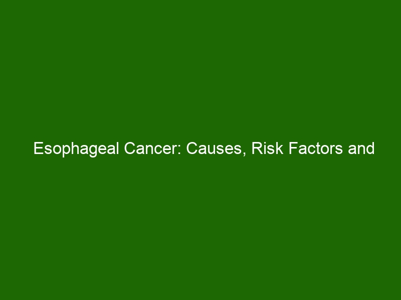 Esophageal Cancer Causes, Risk Factors and Treatment Options Health