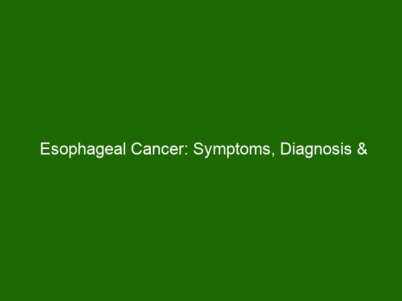 Esophageal Cancer Symptoms Diagnosis And Treatment Options Health And