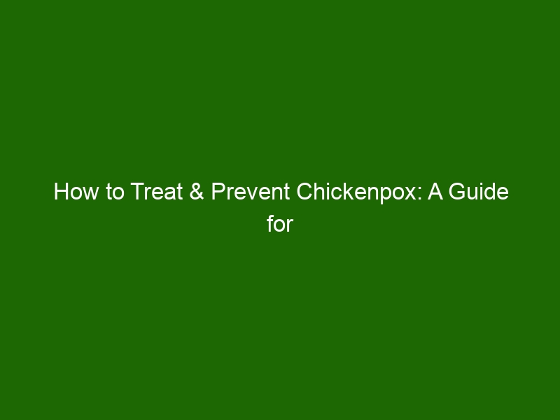 How To Treat & Prevent Chickenpox: A Guide For Parents - Health And Beauty