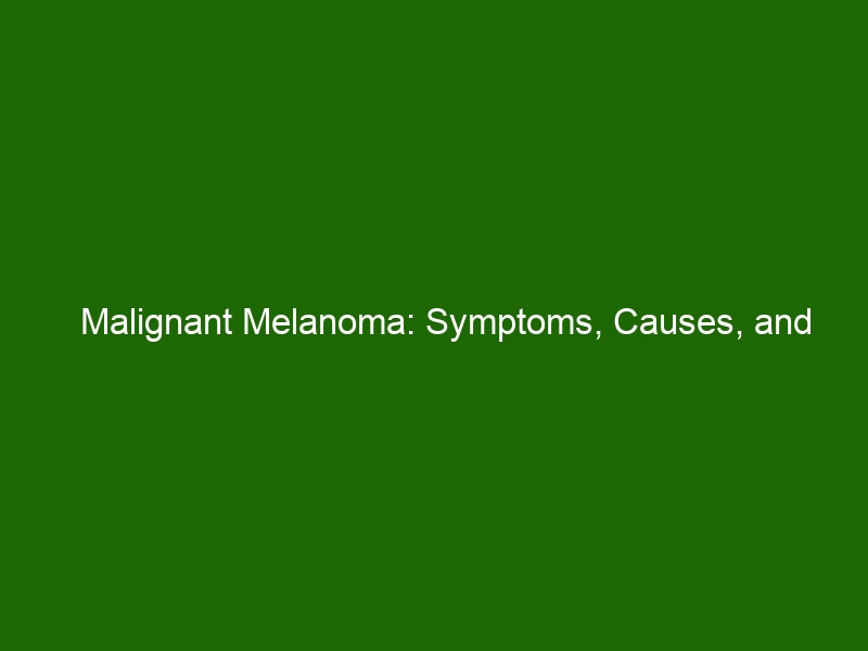 Malignant Melanoma: Symptoms, Causes, and Treatment - Health And Beauty