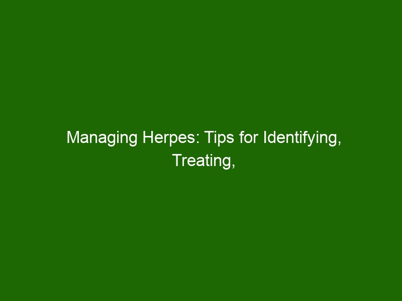 Managing Herpes Tips For Identifying Treating And Living With The Condition Health And Beauty 