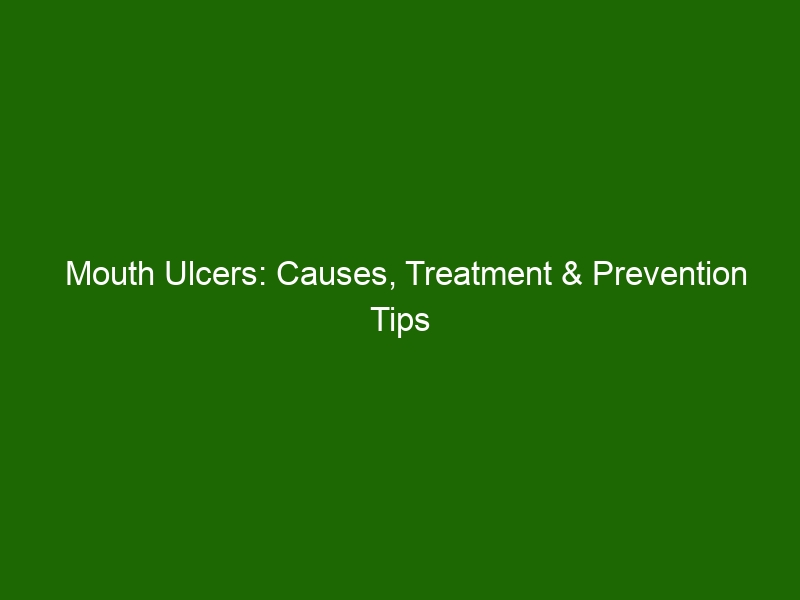 Mouth Ulcers Causes Treatment And Prevention Tips Health And Beauty 4979