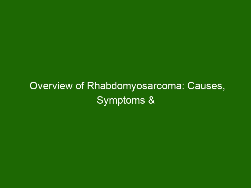 Overview Of Rhabdomyosarcoma Causes Symptoms And Treatment Health And Beauty 8281