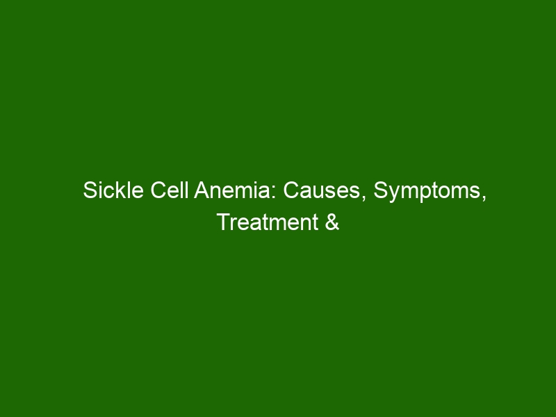 Sickle Cell Anemia: Causes, Symptoms, Treatment & Prevention - Health ...