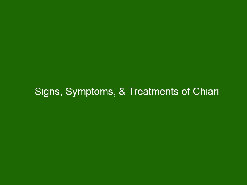 Signs, Symptoms, & Treatments of Chiari Malformation: What You Need To ...