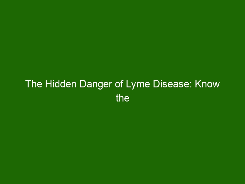 The Hidden Danger Of Lyme Disease Know The Symptoms And Risks Health And Beauty