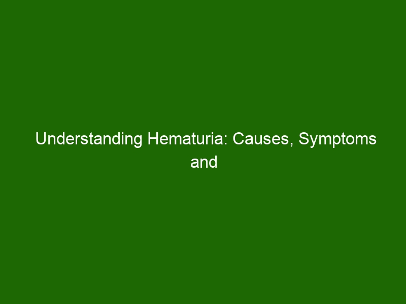 Understanding Hematuria Causes Symptoms And Treatment Options Health And Beauty 