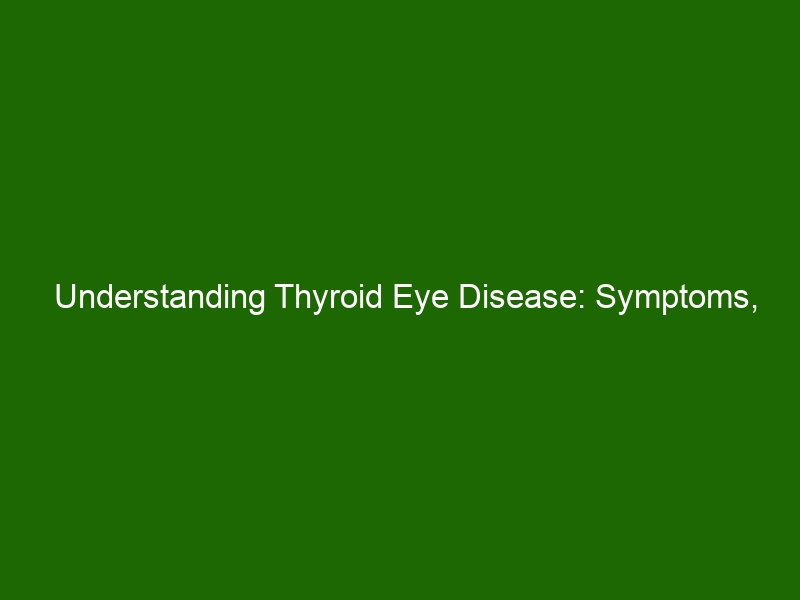 Understanding Thyroid Eye Disease Symptoms Causes And Treatment Health And Beauty 2525