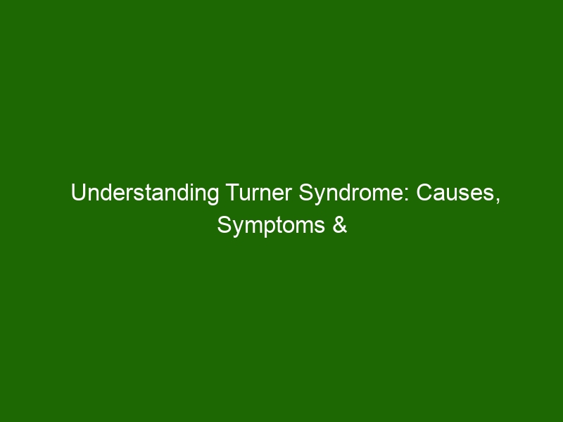 Understanding Turner Syndrome Causes Symptoms And Treatment Health