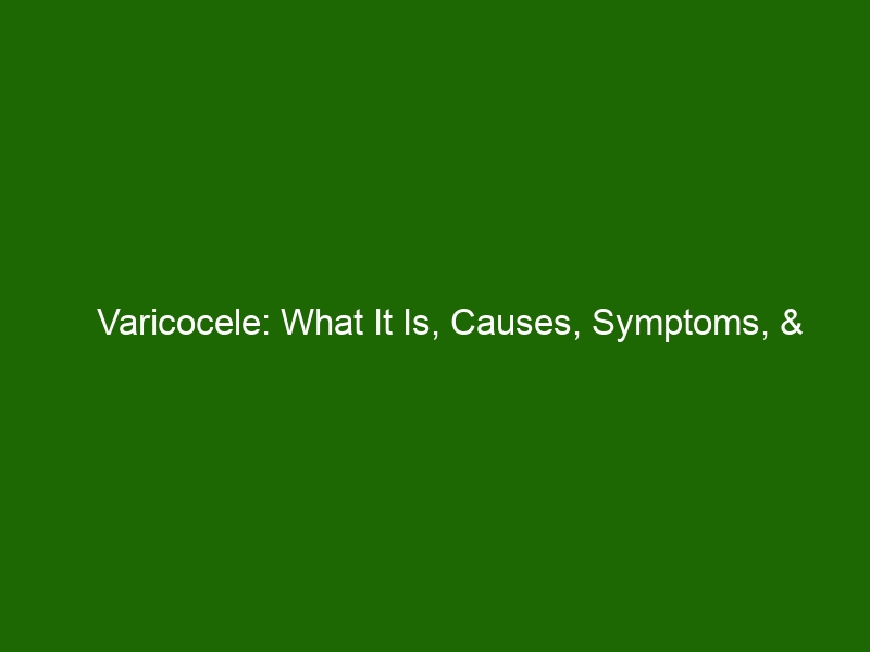 Varicocele What It Is Causes Symptoms And Possible Treatments