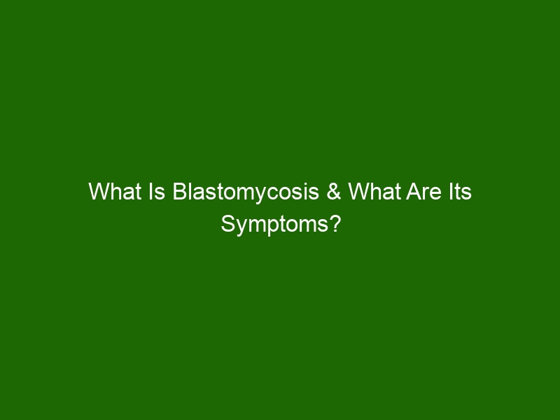 What Is Blastomycosis And What Are Its Symptoms Health And Beauty 
