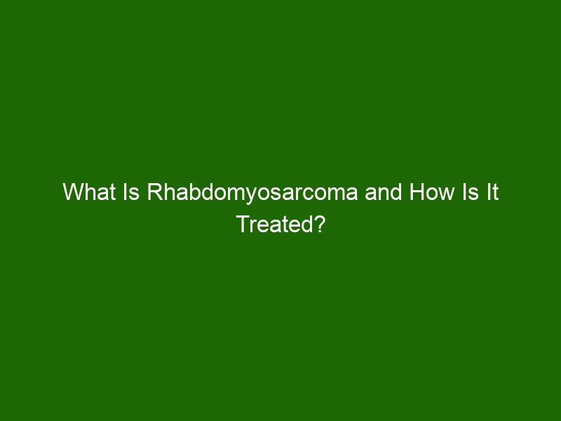 What Is Rhabdomyosarcoma and How Is It Treated? - Health And Beauty